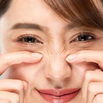 Bunny lines treatment