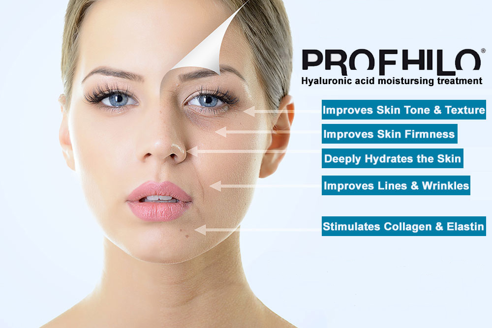 Profhilo